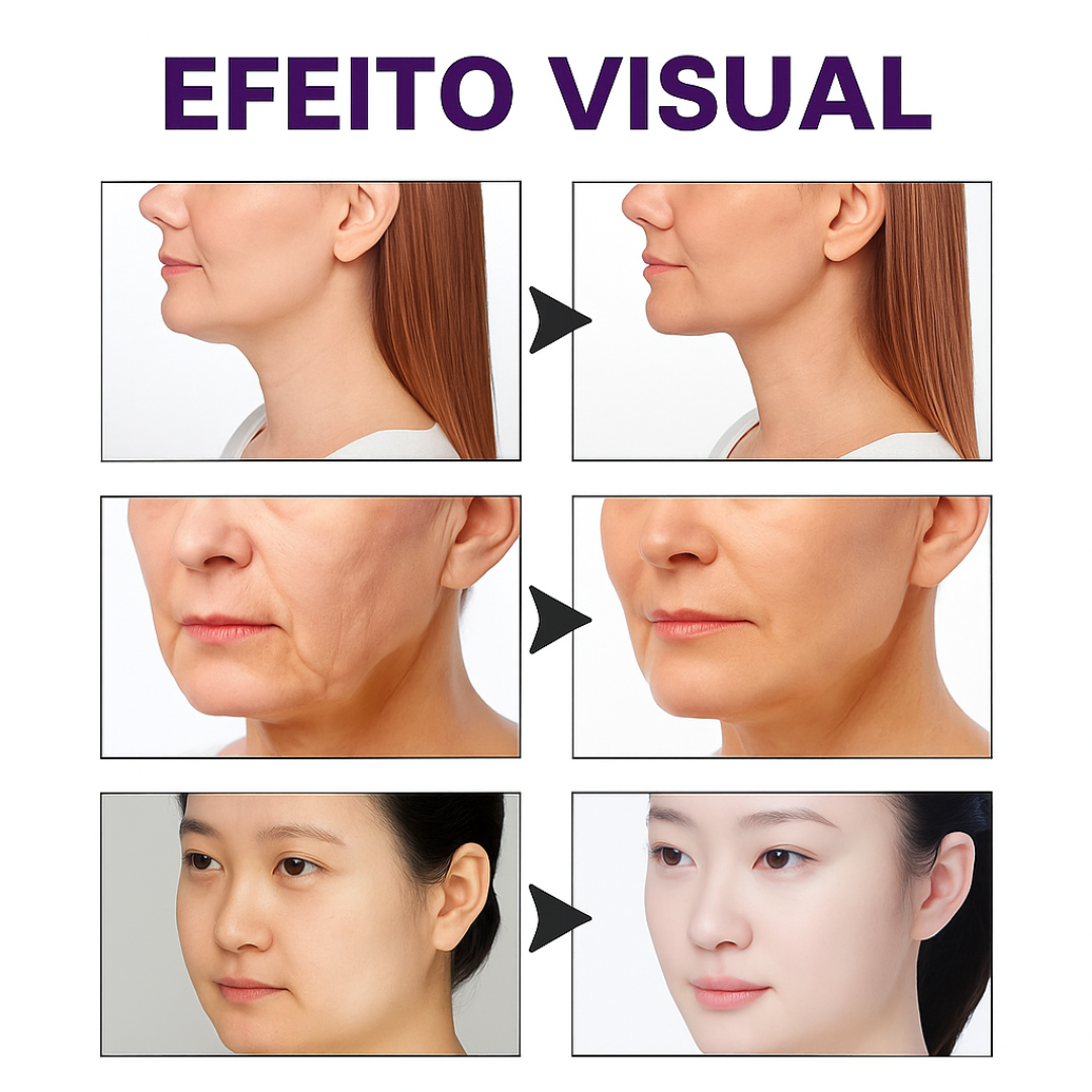 DermaLift Tape™ — Fita Lifting Invisível