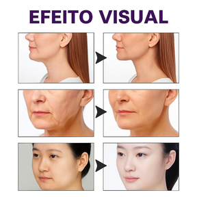 DermaLift Tape™ — Fita Lifting Invisível